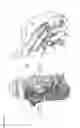 Fig. 31 - Antibody drug conjugates