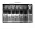 Fig. 06 - Color tunable multifunctional nanophosphor, synthesis method thereof, and polymer composite including the nanophosphor