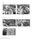 Fig. 02 - PEST CONTROL COMPOSITION AND METHOD FOR PREPARING SAME