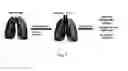 Fig. 02 - Organs for transplantation