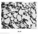 Fig. 06 - Organs for transplantation