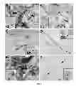 Fig. 04 - Methods for use of neural stem cell compositions for treatment of central nervous system lesions