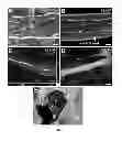 Fig. 06 - Methods for use of neural stem cell compositions for treatment of central nervous system lesions