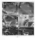 Fig. 07 - Methods for use of neural stem cell compositions for treatment of central nervous system lesions
