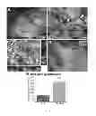 Fig. 09 - Methods for use of neural stem cell compositions for treatment of central nervous system lesions
