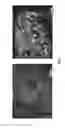 Fig. 02 - Anti-OX40 antibodies and methods of treating cancer