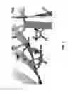 Fig. 02 - Immunogenic composition comprising Panton-Valentine Leukocidin (PVL) derived polypeptides