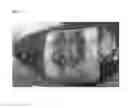 Fig. 06 - Hemostatic sponge