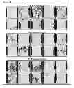 Fig. 03 - Compositions and Methods for Spine Fusion Procedures