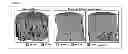 Fig. 05 - Compositions and Methods for Spine Fusion Procedures