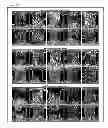 Fig. 07 - Compositions and Methods for Spine Fusion Procedures