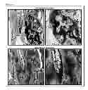 Fig. 08 - Compositions and Methods for Spine Fusion Procedures