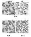 Fig. 09 - Methods of treating gram-negative microbial infections