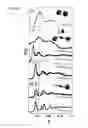 Fig. 35 - Methods for the Bio-programmable Crystallization of Multi-component Functional Nanoparticle Systems