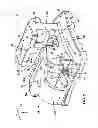Fig. 02 - Self-ligating orthodontic bracket