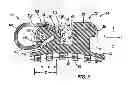 Fig. 06 - Self-ligating orthodontic bracket