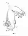 Fig. 02 - Dental aspiration device and method of use