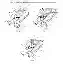 Fig. 06 - SHOELACE TYING AIDE FOR DEVELOPMENT AND LEARNING OF THE SHOELACE TYING PROCESS