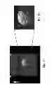 Fig. 08 - Ultrasound phantom models, materials, and methods