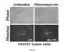 Fig. 02 - Method of Determining Susceptibility of a Tumor Cell to a Chemotherapeutic Agent: Novel Use of Herpes SImplex Virus