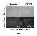 Fig. 04 - Method of Determining Susceptibility of a Tumor Cell to a Chemotherapeutic Agent: Novel Use of Herpes SImplex Virus