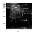 Fig. 09 - Characterizing melanoma