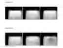 Fig. 03 - METHOD FOR DETECTION OF COAGULATION ACTIVITY AND BIOMARKERS