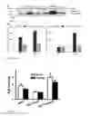Fig. 08 - Biomarker for abdominal aortic aneurysm