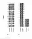 Fig. 02 - Method for detecting the presence of expanded spectrum β-lactamase-producing bacteria in a sample