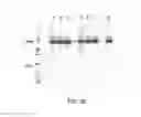 Fig. 06 - Method of protein purification from 