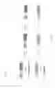Fig. 09 - HIGH THROUGHPUT METHOD FOR ASSEMBLY AND CLONING POLYNUCLEOTIDES COMPRISING HIGHLY SIMILAR POLYNUCLEOTIDIC MODULES