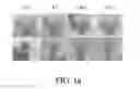 Fig. 02 - METHOD OF INHIBITING HAMARTOMA TUMOR CELLS