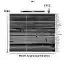 Fig. 02 - METHODS FOR SELECTING AND TREATING CANCER IN PATIENTS WITH IGF-1R/IR INHIBITORS