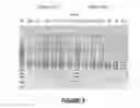 Fig. 06 - Antisense oligonucleotides for inducing exon skipping and methods of use thereof