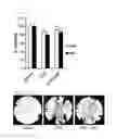 Fig. 02 - Pharmaceutical Composition for Preventing or Treating Disease with Bone Mass Loss Comprising Diaminodiphenylsulfone or Pharmaceutically Acceptable Salt Thereof