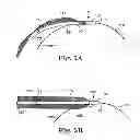 Fig. 07 - Surgical articles and methods for treating pelvic conditions