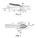 Fig. 08 - Surgical articles and methods for treating pelvic conditions