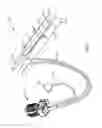 Fig. 02 - Penile prosthesis