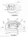 Fig. 06 - Self-retaining retractor