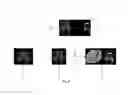 Fig. 04 - Method of Automatically Analyzing Brain Fiber Tracts Information