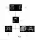 Fig. 06 - Method of Automatically Analyzing Brain Fiber Tracts Information