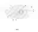 Fig. 09 - Microwave antenna apparatus, systems, and methods for localizing markers or tissue structures within a body