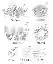Fig. 28 - Microwave antenna apparatus, systems, and methods for localizing markers or tissue structures within a body