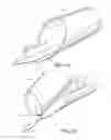 Fig. 16 - METHODS, DEVICES AND THERAPEUTIC PLATFORM FOR AUTOMATED, SELECTABLE, SOFT TISSUE RESECTION