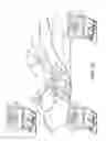 Fig. 26 - METHODS, DEVICES AND THERAPEUTIC PLATFORM FOR AUTOMATED, SELECTABLE, SOFT TISSUE RESECTION
