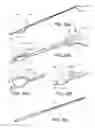 Fig. 30 - METHODS, DEVICES AND THERAPEUTIC PLATFORM FOR AUTOMATED, SELECTABLE, SOFT TISSUE RESECTION