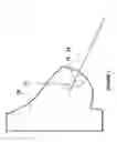 Fig. 05 - Brachytherapy fiducial needle fixation system and method