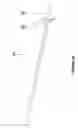 Fig. 14 - Brachytherapy fiducial needle fixation system and method