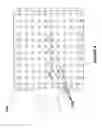 Fig. 20 - Brachytherapy fiducial needle fixation system and method