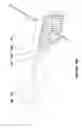 Fig. 32 - Brachytherapy fiducial needle fixation system and method